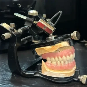 protesis-2 Modelo de prótesis dental
