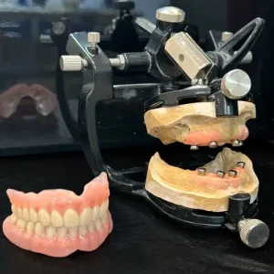 protesis-3 prótesis dental para paciente