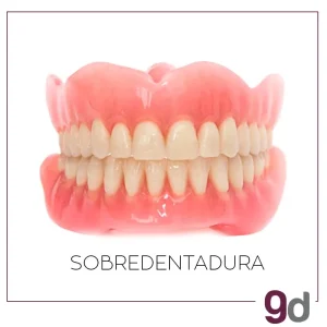 sobredentadura-modelo Modelo Sobredentadura