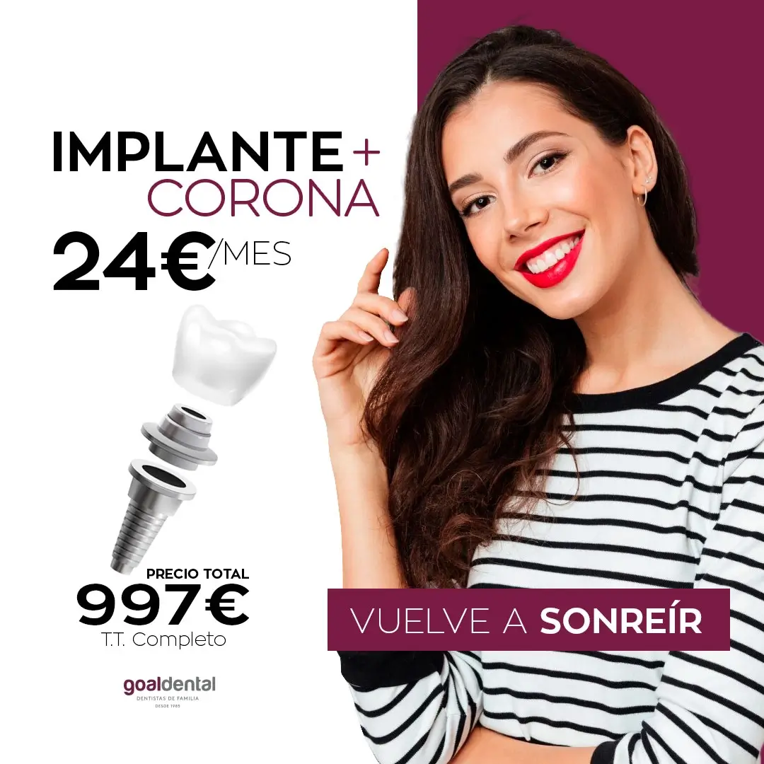 implante-+-corona Implante dental + corona tratamiento