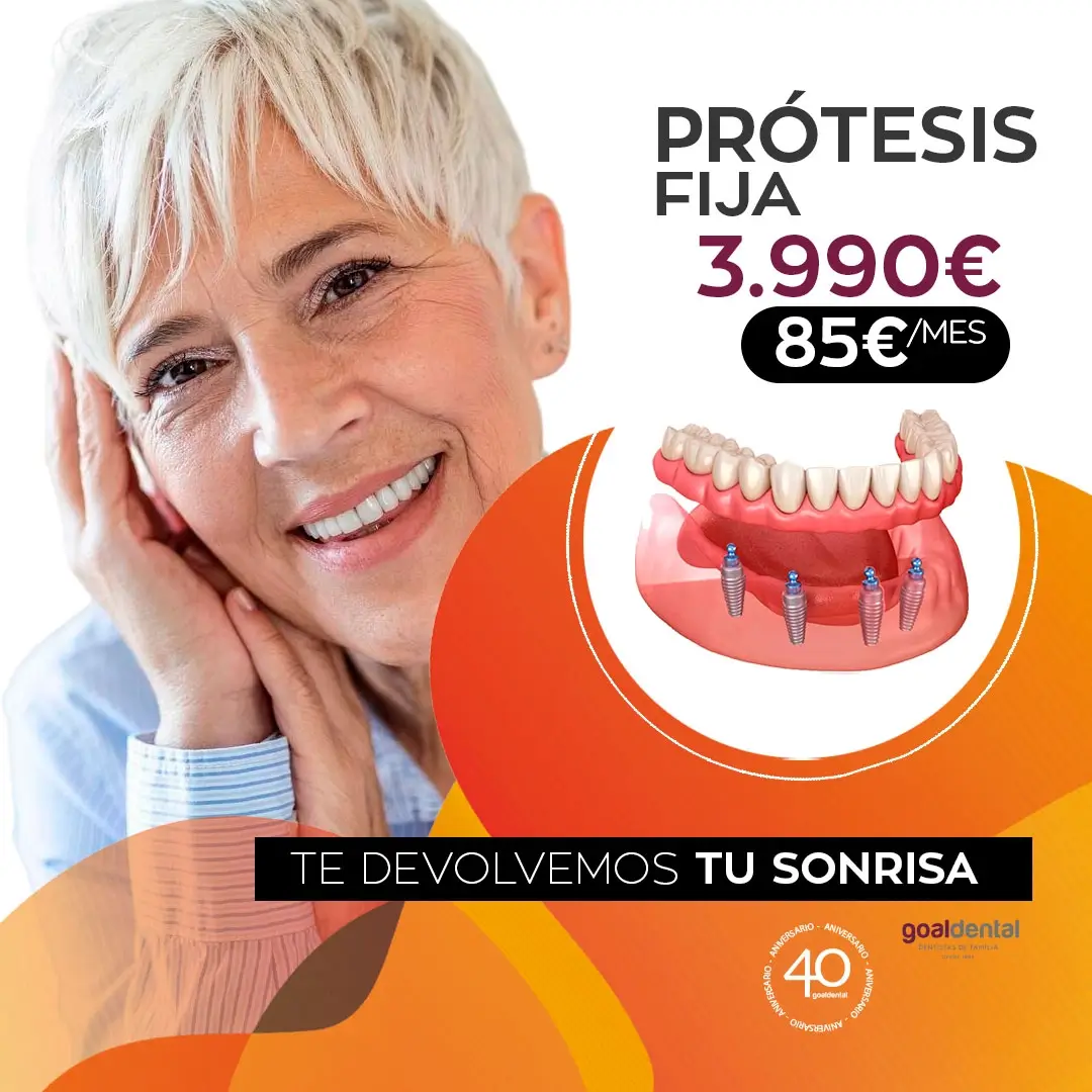 goaldental-sobredentadura Clínicas GoalDental 40 años