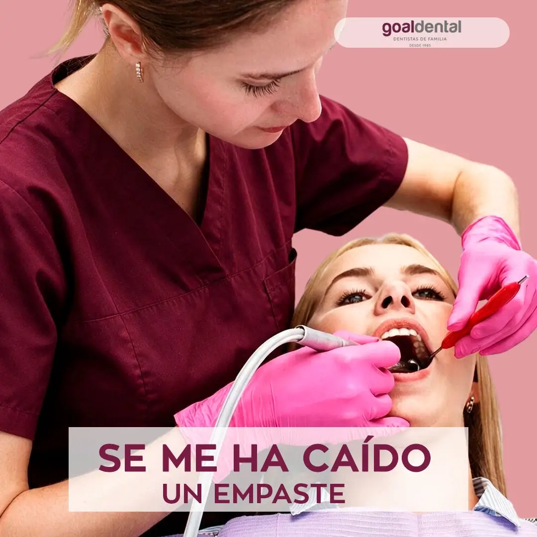 Se me ha caido un empaste