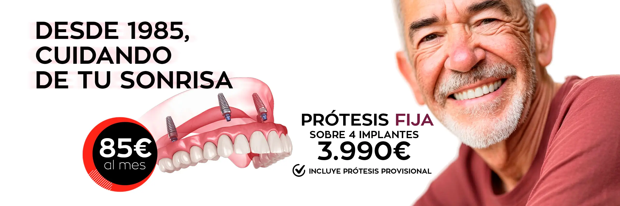 protesis-sobre-4-implantes-goaldental Clínicas GoalDental