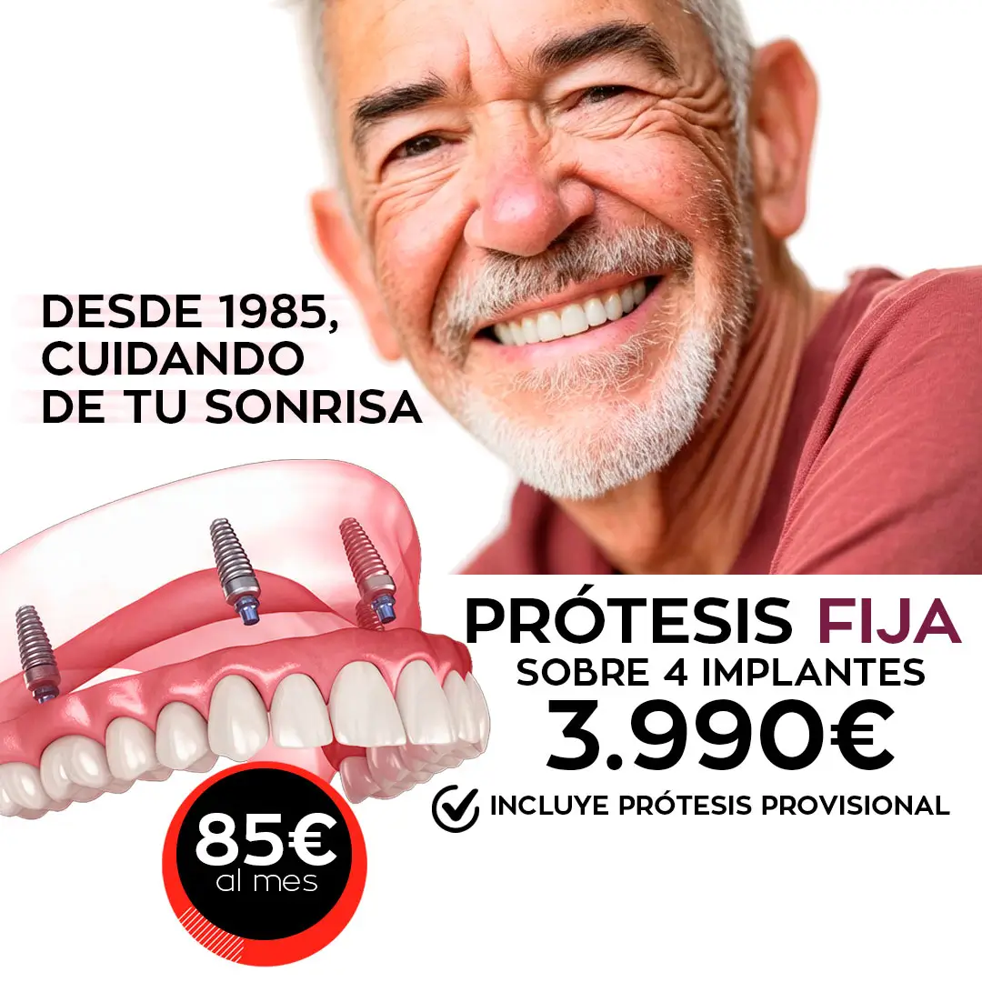 protesis-sobre-4implantes-clinicasgoaldental GoalDental